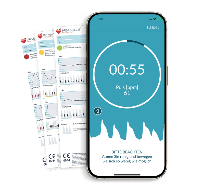 Preventicus Heartbeats App bei laufender Herzrhythmusmessung mit PDF-Berichten