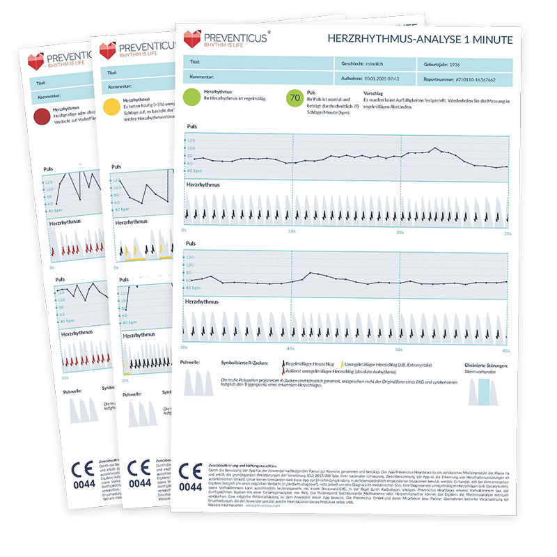 EKG-vergleichbarer PDF-Bericht der Preventicus Heartbeats Herzrhythmus-Analyse
