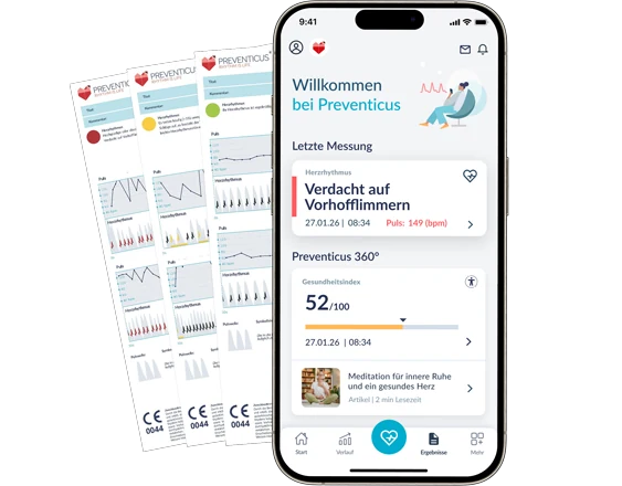 Startansicht der Preventicus-App mit Hinweis auf Verdacht auf Vorhofflimmern und Herzrhythmus-Analyse.
