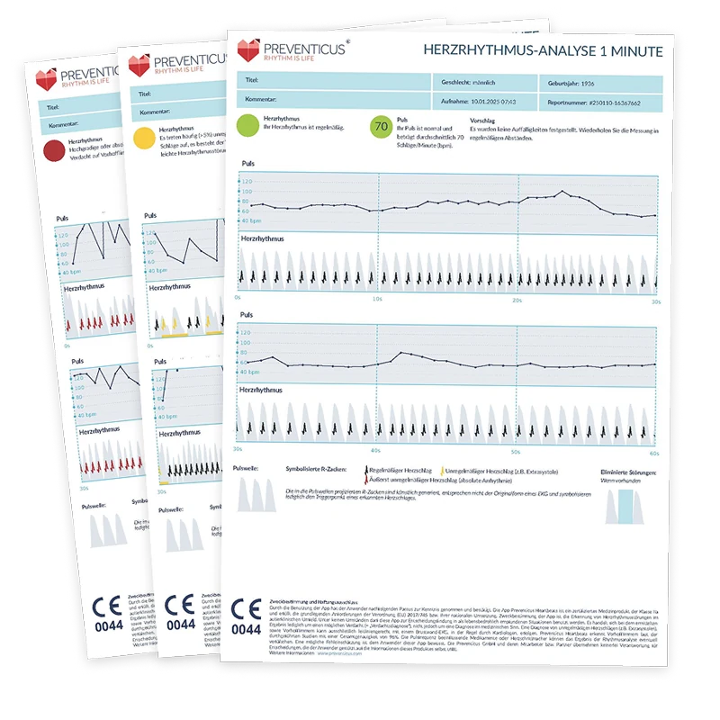 PDF-Bericht der Preventicus Herzrhythmus-Analyse mit Puls- und Herzrhythmusauswertung zur medizinischen Dokumentation.