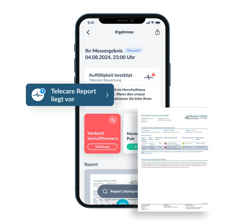 Preventicus-App mit Telecare-Report und bestätigtem Verdacht auf Vorhofflimmern inklusive medizinischem Bericht.